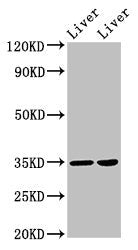 Western Blot Positive WB detected in: Rat liver tissue, Mouse liver tissue All lanes: NANOGP8 antibody at 2µg/ml Secondary Goat polyclonal to rabbit IgG at 1/50000 dilution Predicted band size: 35 kDa Observed band size: 35 kDa