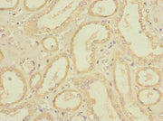 Immunohistochemistry of paraffin-embedded human kidney tissue using CSB-PA754137LA01HU at dilution of 1:100