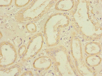 Immunohistochemistry of paraffin-embedded human kidney tissue using CSB-PA754137LA01HU at dilution of 1:100