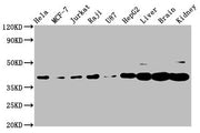 Western Blot Positive WB detected in: Hela whole cell lysate, MCF-7 whole cell lysate, Jurkat whole cell lysate, Raji whole cell lysate, U87 whole cell lysate, HepG2 whole cell lysate, Rat liver tissue, Mouse brain tissue, Mouse kidney tissue All...