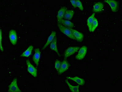 Immunofluorescence staining of HepG2 cells with CSB-PA754193LA01HU at 1:100, counter-stained with DAPI. The cells were fixed in 4% formaldehyde, permeabilized using 0.2% Triton X-100 and blocked in 10% normal Goat Serum. The cells were then incuba...