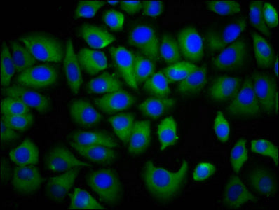 Immunofluorescence staining of A549 cells with CSB-PA754272LA01HU at 1:166, counter-stained with DAPI. The cells were fixed in 4% formaldehyde, permeabilized using 0.2% Triton X-100 and blocked in 10% normal Goat Serum. The cells were then incubat...