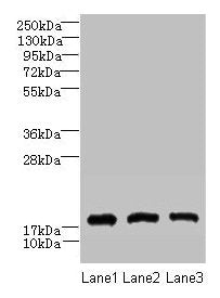 Western blot All lanes: CNIH2 antibody at 2µg/ml Lane 1: U251 whole cell lysate Lane 2: Mouse liver tissue Lane 3: Mouse kidney tissue Secondary Goat polyclonal to rabbit IgG at 1/10000 dilution Predicted band size: 19 kDa Observed band size: 19 kDa