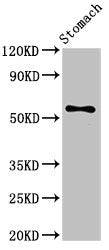 Western Blot Positive WB detected in: Mouse stomach tissue All lanes: SMARCD3 antibody at 3.4ug/ml Secondary Goat polyclonal to rabbit IgG at 1/50000 dilution Predicted band size: 56, 54 kDa Observed band size: 56 kDa