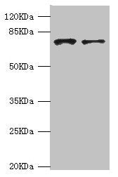 Western blot All lanes: GBE1 antibody at 3.13ug/ml Lane 1: HepG2 whole cell lysate Lane 2: Hela whole cell lysate Secondary Goat polyclonal to rabbit IgG at 1/10000 dilution Predicted band size: 80 kDa Observed band size: 80 kDa