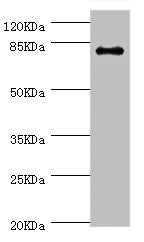 Western blot All lanes: GBE1 antibody at 3.13ug/ml + Mouse liver tissue Secondary Goat polyclonal to rabbit IgG at 1/10000 dilution predicted band size 80 kDa Observed band size: 80 kDa