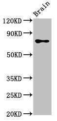 Western Blot Positive WB detected in: Rat brain tissue All lanes: CASC1 antibody at 3.4ug/ml Secondary Goat polyclonal to rabbit IgG at 1/50000 dilution Predicted band size: 84, 79, 82, 76 kDa Observed band size: 84 kDa