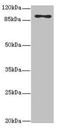 Western blot All lanes: MTHFD1L antibody at 3.68µg/ml + Hela whole cell lysate Secondary Goat polyclonal to rabbit IgG at 1/10000 dilution Predicted band size: 106, 30 kDa Observed band size: 106 kDa