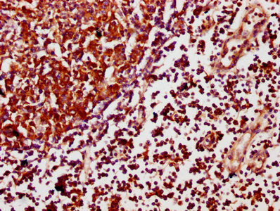 IHC image of CSB-PA754405LA01HU diluted at 1:500 and staining in paraffin-embedded human lymph node tissue performed on a Leica BondTM system. After dewaxing and hydration, antigen retrieval was mediated by high pressure in a citrate buffer (pH 6....