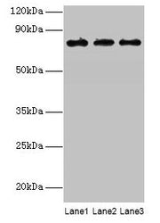 Western blot All lanes: KIRREL2 antibody at 8µg/ml Lane 1: Mouse gonadal tissue Lane 2: Mouse lung tissue Lane 3: Mouse heart tissue Secondary Goat polyclonal to rabbit IgG at 1/10000 dilution Predicted band size: 76, 68, 62, 24 kDa Observed band...
