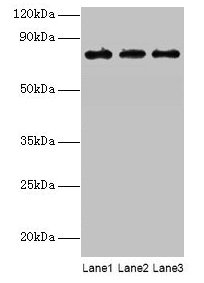 Western blot All lanes: KIRREL2 antibody at 8µg/ml Lane 1: Mouse gonadal tissue Lane 2: Mouse lung tissue Lane 3: Mouse heart tissue Secondary Goat polyclonal to rabbit IgG at 1/10000 dilution Predicted band size: 76, 68, 62, 24 kDa Observed band...