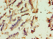 Immunohistochemistry of paraffin-embedded human prostate tissue using CSB-PA754540ESR1HU at dilution of 1:100