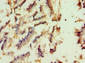 Immunohistochemistry of paraffin-embedded human prostate tissue using CSB-PA754540ESR1HU at dilution of 1:100