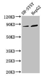 Western Blot Positive WB detected in: SH-SY5Y whole cell lysate, HepG2 whole cell lysate All lanes: DPY19L3 antibody at 3.4µg/ml Secondary Goat polyclonal to rabbit IgG at 1/50000 dilution Predicted band size: 84, 63 kDa Observed band size: 84 kDa