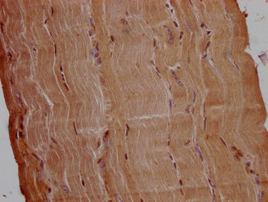 IHC image of CSB-PA754631LA01HU diluted at 1:200 and staining in paraffin-embedded human skeletal muscle tissue performed on a Leica BondTM system. After dewaxing and hydration, antigen retrieval was mediated by high pressure in a citrate buffer (...