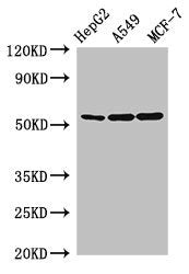 Western Blot Positive WB detected in: HepG2 whole cell lysate, A549 whole cell lysate, MCF-7 whole cell lysate All lanes: SLC24A5 antibody at 2.5µg/ml Secondary Goat polyclonal to rabbit IgG at 1/50000 dilution Predicted band size: 55, 49 kDa Obse...