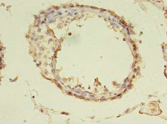Immunohistochemistry of paraffin-embedded human testis tissue using CSB-PA754656LA01HU at dilution of 1:100