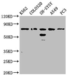 Western Blot Positive WB detected in: K562 whole cell lysate, Colo320 whole cell lysate, SH-SY5Y whole cell lysate, A549 whole cell lysate, PC-3 whole cell lysate All lanes: BRINP3 antibody at 3.8µg/ml Secondary Goat polyclonal to rabbit IgG at 1/...
