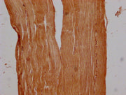 Immunohistochemistry of paraffin-embedded human skeletal muscle tissue using CSB-PA755482LA01HU at dilution of 1:300