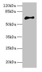Western blot All lanes: ARMCX2 antibody at 5µg/ml + MCF-7 whole cell lysate Secondary Goat polyclonal to rabbit IgG at 1/10000 dilution Predicted band size: 66 kDa Observed band size: 66 kDa