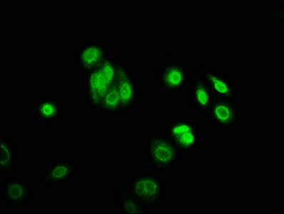 Immunofluorescence staining of HepG2 cells with CSB-PA755509LA01HU at 1:166, counter-stained with DAPI. The cells were fixed in 4% formaldehyde, permeabilized using 0.2% Triton X-100 and blocked in 10% normal Goat Serum. The cells were then incuba...