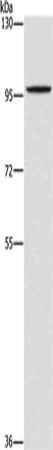 Gel: 6%SDS-PAGE, Lysate: 40 ug, Lane: A172 cells, Primary antibody: CSB-PA755655(PDE6C Antibody) at dilution 1/1400, Secondary antibody: Goat anti rabbit IgG at 1/8000 dilution, Exposure time: 10 seconds