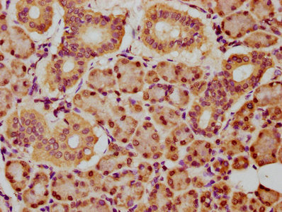IHC image of CSB-PA755911LA01HU diluted at 1:150 and staining in paraffin-embedded human pancreatic tissue performed on a Leica BondTM system. After dewaxing and hydration, antigen retrieval was mediated by high pressure in a citrate buffer (pH 6....