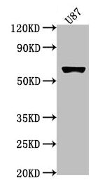 Western Blot Positive WB detected in: U87 whole cell lysate All lanes: USP17L1 antibody at 1:2000 Secondary Goat polyclonal to rabbit IgG at 1/50000 dilution Predicted band size: 60 kDa Observed band size: 60 kDa