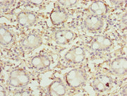 Immunohistochemistry of paraffin-embedded human colon tissue using CSB-PA757108LA01HU at dilution of 1:100