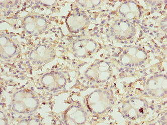 Immunohistochemistry of paraffin-embedded human colon tissue using CSB-PA757108LA01HU at dilution of 1:100