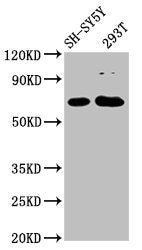 Western Blot Positive WB detected in: SH-SY5Y whole cell lysate, 293T whole cell lysate All lanes: GALNT9 antibody at 2.4µg/ml Secondary Goat polyclonal to rabbit IgG at 1/50000 dilution Predicted band size: 69, 28 kDa Observed band size: 69 kDa