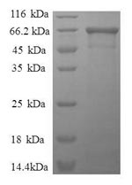 Recombinant Human Fructose-bisphosphate aldolase A (ALDOA)