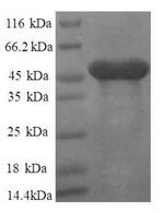 Recombinant Human 60S ribosomal protein L11 (RPL11), partial