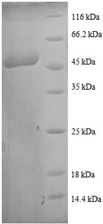 Recombinant Human Transgelin (TAGLN)