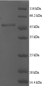 Recombinant Human ADP-ribosylation factor 5 (ARF5)