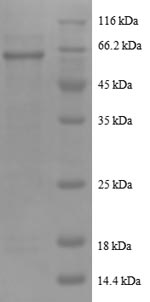 Recombinant Human Serine/threonine-protein phosphatase 2A catalytic subunit beta isoform (PPP2CB)