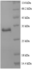 Recombinant Human Actin, cytoplasmic 1 (ACTB), partial