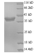 Recombinant Human Ubiquitin-like FUBI-ribosomal protein eS30 fusion protein (FAU)