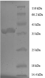Recombinant Human Peptidyl-prolyl cis-trans isomerase FKBP1A (FKBP1A), partial