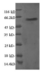 Recombinant Human 60S ribosomal protein L5 (RPL5)