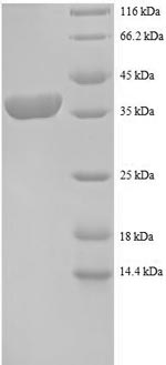 Recombinant Human 40S ribosomal protein S12 (RPS12)
