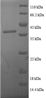 Recombinant Human Thioredoxin (TXN)