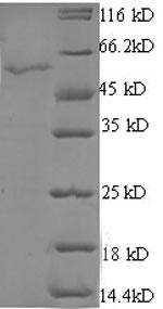 Recombinant Human StAR-related lipid transfer protein 7, mitochondrial (STARD7), partial