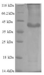 Recombinant Human Protein phosphatase 1 regulatory subunit 11 (PPP1R11)