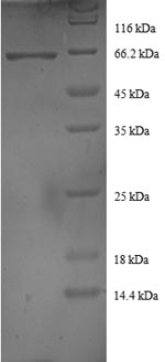 Recombinant Human DnaJ homolog subfamily B member 1 (DNAJB1)