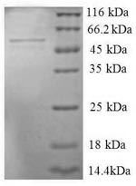 Recombinant human Seryl-tRNA synthetase,Cytoplasmic domain protein (SERS), partial