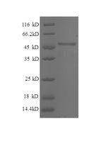 Recombinant Human Breast cancer metastasis-suppressor 1 (BRMS1), partial