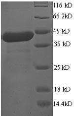 Recombinant Human Programmed cell death protein 6 (PDCD6)