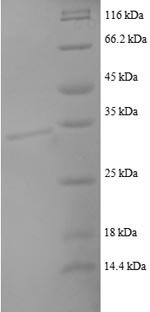 Recombinant Human C-C motif chemokine 22 (CCL22), partial