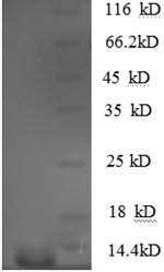 Recombinant Human C-C motif chemokine 5 (CCL5)